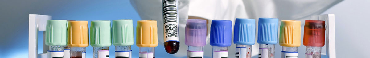 Two D Tube Barcode